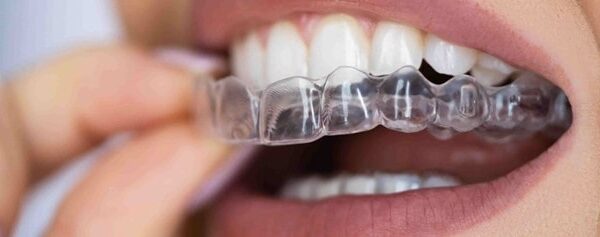 خدمات ارتودنسی شفاف در تبریز با بهترین امکانات