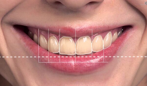 لبخند هالیوودی با دکتر صدر