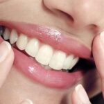 لبخند زیبا با ارتودنسی پیشرفته