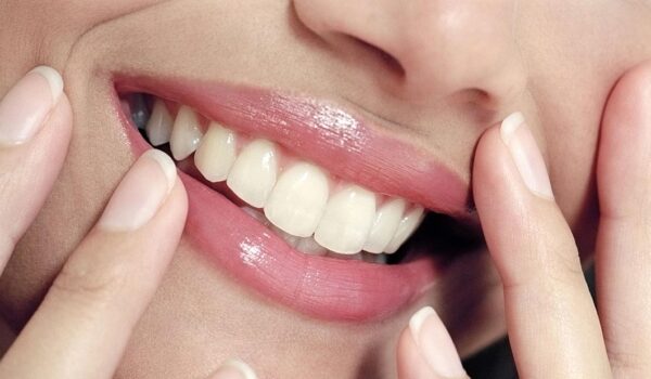 لبخند زیبا با ارتودنسی پیشرفته