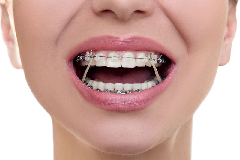 راهنمای جامع انتخاب متخصص ارتودنسی در تبریز